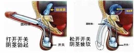 为什么要植入假体 为什么要假植