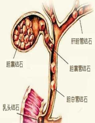 胆没了有什么影响（胆没了怎么办）