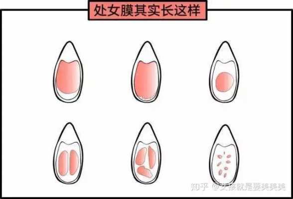 女生下面是什么味道的,处nu膜是怎样才算破了 