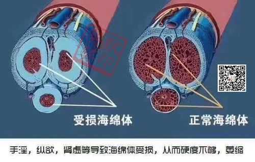 关键时刻硬不起是什么情况,行房时硬不起是什么原因 