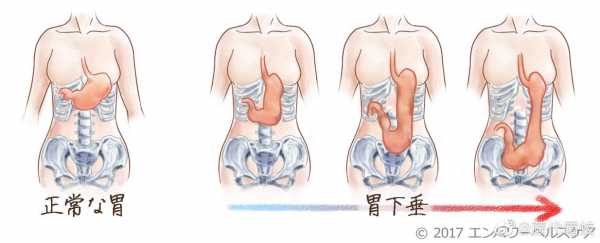 胃下垂什么原因_胃下垂什么症状