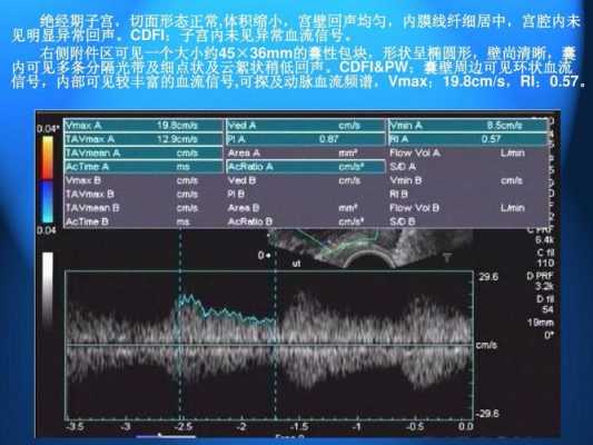 宫壁低回声区怎么回事 宫壁低回声结节是什么