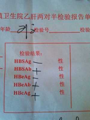 hbeag阴性是什么意思 hbsag阴性是什么意思