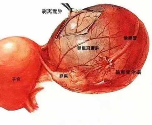 腹部包块是什么意思_腹部包块常见原因