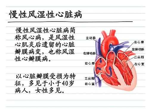 什么是风湿性心脏病? 什么原因导致的?