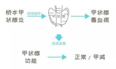 桥本病是什么病（甲亢桥本病是什么病）