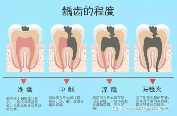 龋齿和蛀牙有什么区别（深龋和浅龋图片）