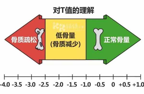 骨密度是什么意思