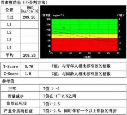 骨密度是什么意思