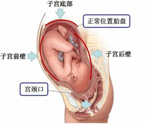 胎盘右侧壁属于前壁还是后壁-胎盘右侧壁是什么意思