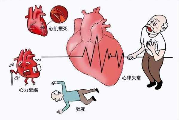 脑供血不足是什么症状,心脏引起的脑供血不足是什么症状 