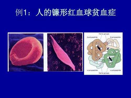 红血球高会引起什么病_红血球高会引起什么病变