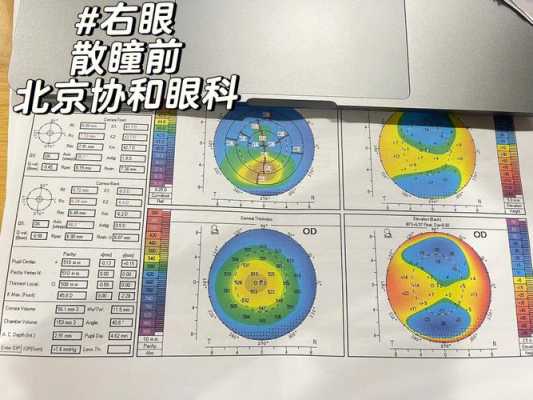 散瞳和散光有什么区别（散瞳和散光的区别）