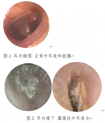  外耳道痒是什么原因「外耳廓一圈痒痒怎么回事」