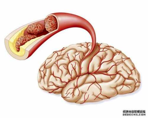 脑供血不足检查什么科目-脑供血不足检查什么