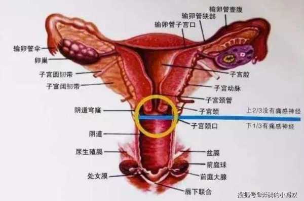 宫颈息肉是什么原因引起的,宫颈息肉是什么原因引起的做病理 