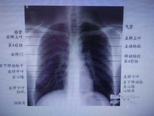 体检胸片是检查什么的