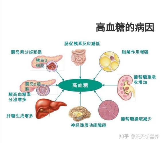 高血糖挂什么科