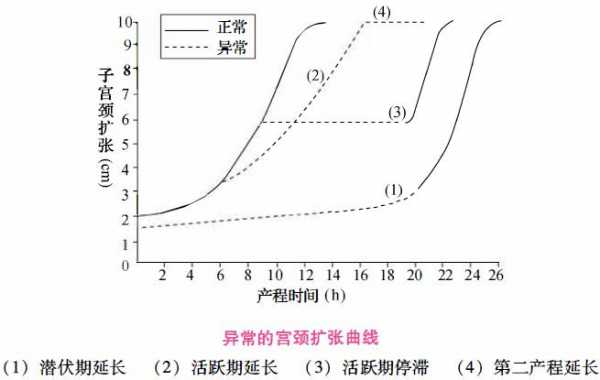 继发性宫缩乏力什么意思