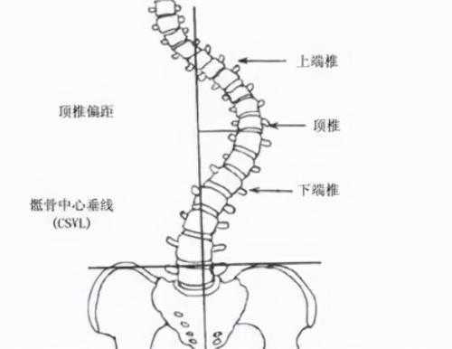 女人尾椎骨突出是什么原因