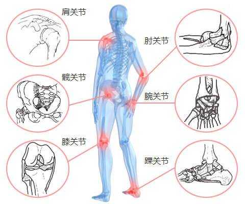 全身骨头痛什么原因引起的呢