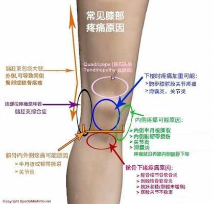 膝盖骨折小腿肌肉痛什么原因