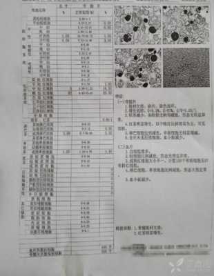 m2什么意思（白血病m2是什么意思）