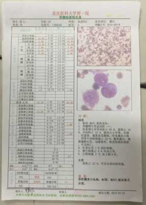 m2什么意思（白血病m2是什么意思）