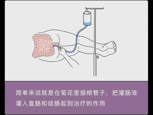 中药灌肠是什么味道-中药灌肠是什么