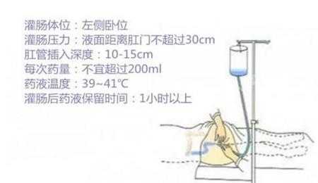 中药灌肠是什么味道-中药灌肠是什么