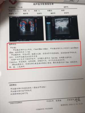 甲状腺结节做什么检查分良性恶性-甲状腺结节做什么检查