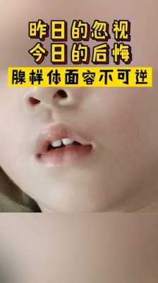  孩子张嘴睡觉是什么原因「六岁孩子张嘴睡觉是什么原因」