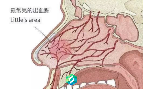 总是流鼻血是什么原因引起的