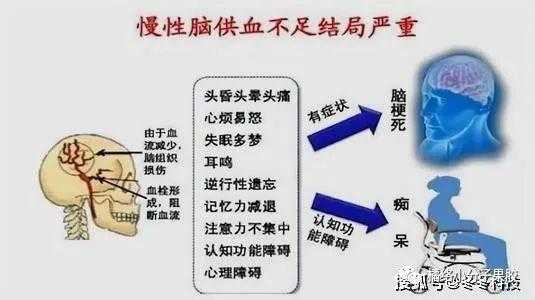  什么是急性脑梗「什么是急性脑梗?什么是慢性脑梗」