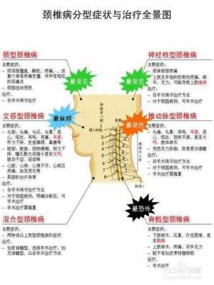 颈椎压迫交感神经怎么治疗最好-颈椎压迫交感神经有什么症状