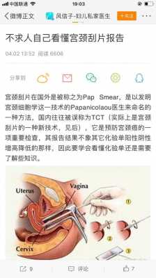 宫颈刮片查什么_宫颈刮片查什么病