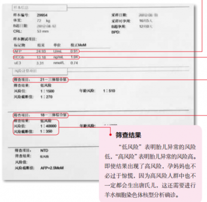  唐氏检查什么「唐筛检查什么时候做最好」