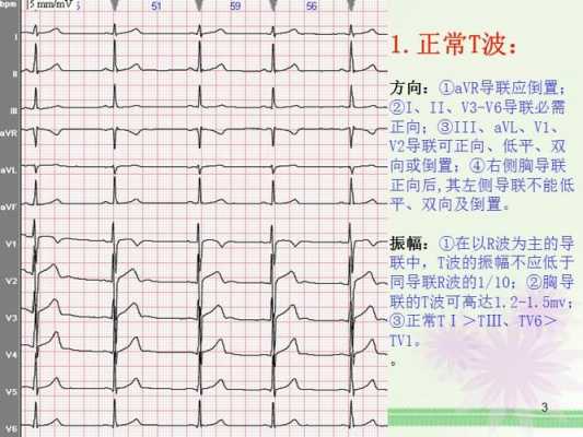 白细胞增高是什么意思,白细胞增高是什么意思非特异性T波改变什么意思 