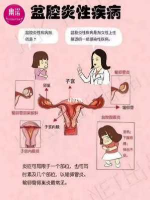  什么原因导致盆腔积液「盆腔炎一般三处疼痛」