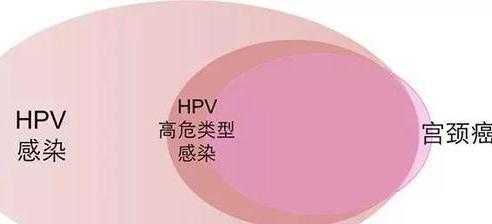  hpv是一种什么病「hpv是一种什么病毒感染」