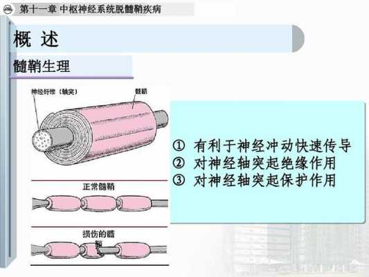 中枢神经脱髓鞘病的症状-中枢神经脱髓鞘病有什么症状