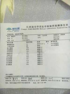 支原体做什么检查能查出来妇科-支原体做什么检查