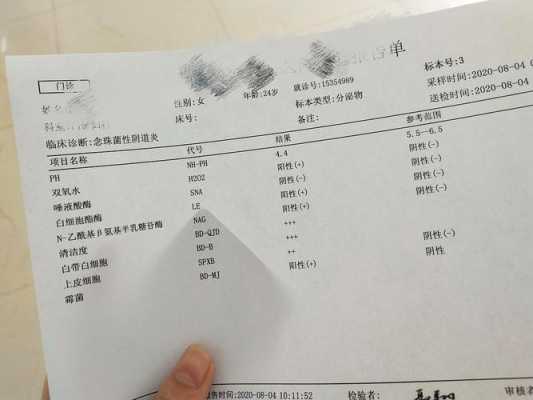 支原体做什么检查能查出来妇科-支原体做什么检查