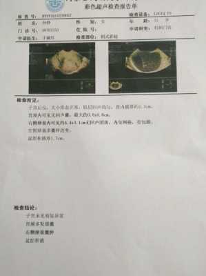 卵巢低回声一般是什么,卵巢偏低回声区 