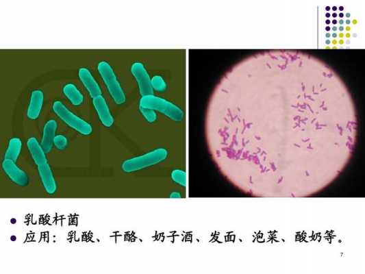 乳酸杆菌大量是什么意思,乳酸杆菌大量是什么意思严重吗 