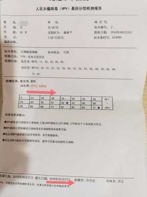 hpv检查是什么检查项目男性-hpv检查是什么检查