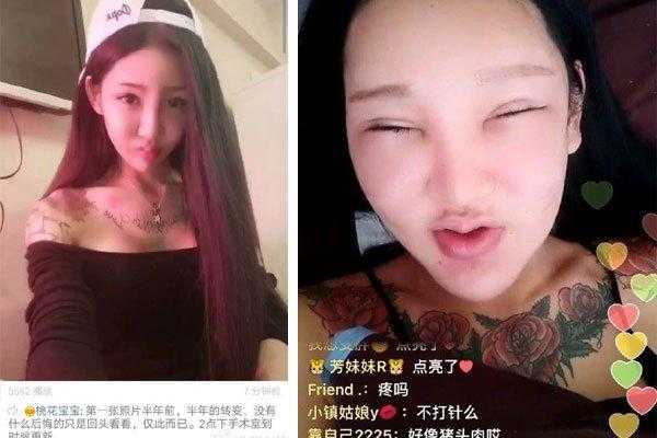 男生整容成女生需要多少钱