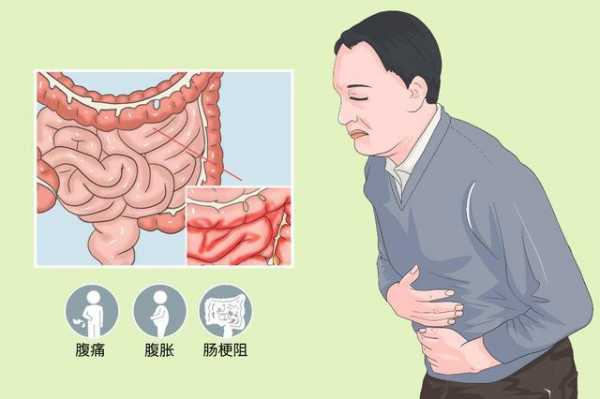  肠粘连是什么原因引起「肠粘连是什么原因引起百度百科」