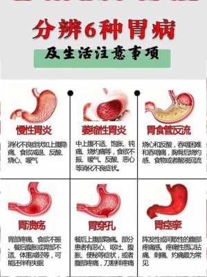 有胃病的人注意事项