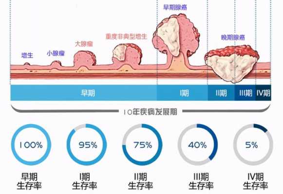  直肠癌是什么原因引起的「直肠癌是什么原因引起的百度知道」